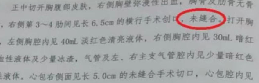 小洛熙事件完整经过梳理：尸检报告公布，手术创口未缝合+血流干而死（组图） - 22