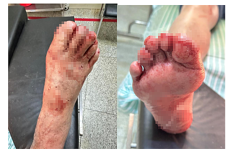 突然炸了！杭州9岁女孩在卫生间痛哭，妈妈冲进一看：头皮发麻……（组图） - 2