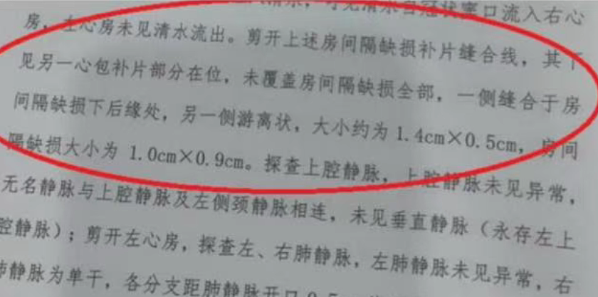 小洛熙事件完整经过梳理：尸检报告公布，手术创口未缝合+血流干而死（组图） - 23