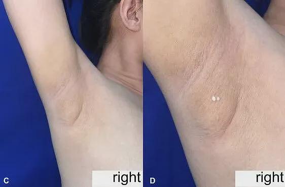 菜刀插进胸膛8年竟浑然不知，这位狠人震惊医学界（组图） - 9