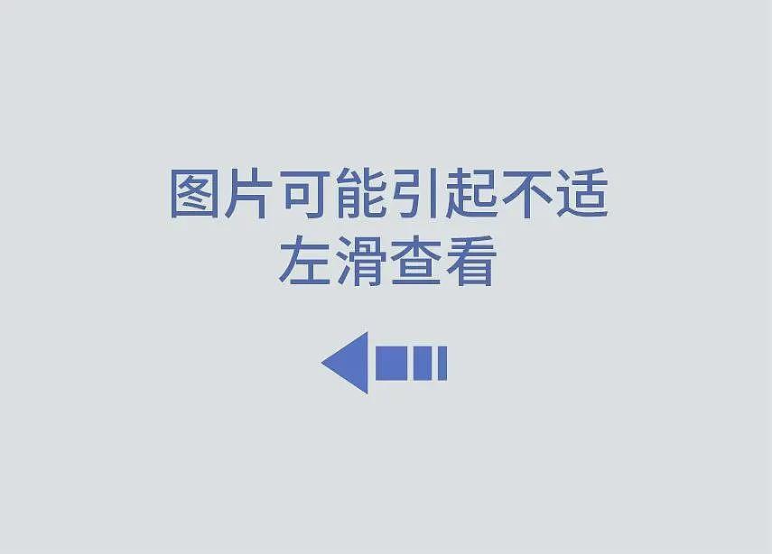 菜刀插进胸膛8年竟浑然不知，这位狠人震惊医学界（组图） - 4