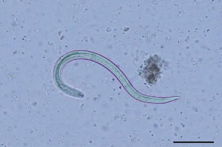 菜刀插进胸膛8年竟浑然不知，这位狠人震惊医学界（组图） - 7