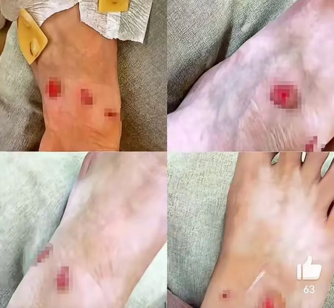 女子买9250元LV运动鞋,穿上走了10分钟就多处严重破皮,要求退货被拒?销售这样回应(组图) - 2