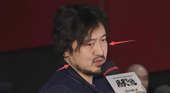 王传君生病后近照变化大,面部浮肿肚子胖成球,疑似因吃药受影响(组图) - 5