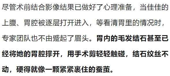 密密麻麻，杭州姑娘体内取出2斤！医生傻眼：你都25岁了...（组图） - 4