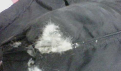 每天穿钻绒羽绒服12小时，男子呼吸衰竭抢救，肺都变成这样了！医生紧急提醒（组图） - 1