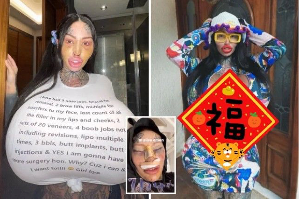沉迷整形，把胸隆炸的网红突然过世？死时已整成外星人，网友怀疑自杀...（组图） - 5