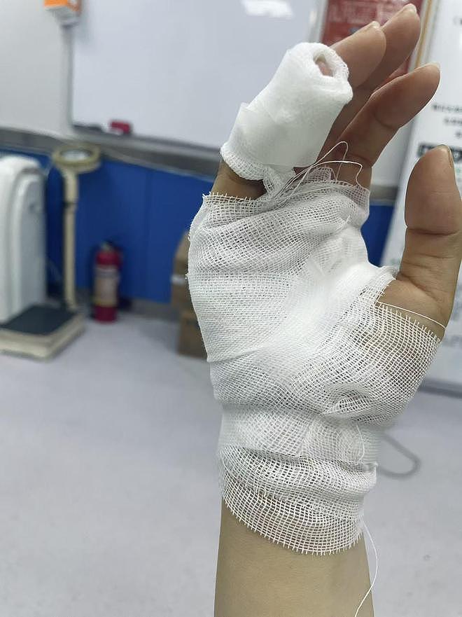 女子洗澡时浴室玻璃突然自爆致受伤,开发商:已超质保期,会妥善回应业主诉求(组图) - 3