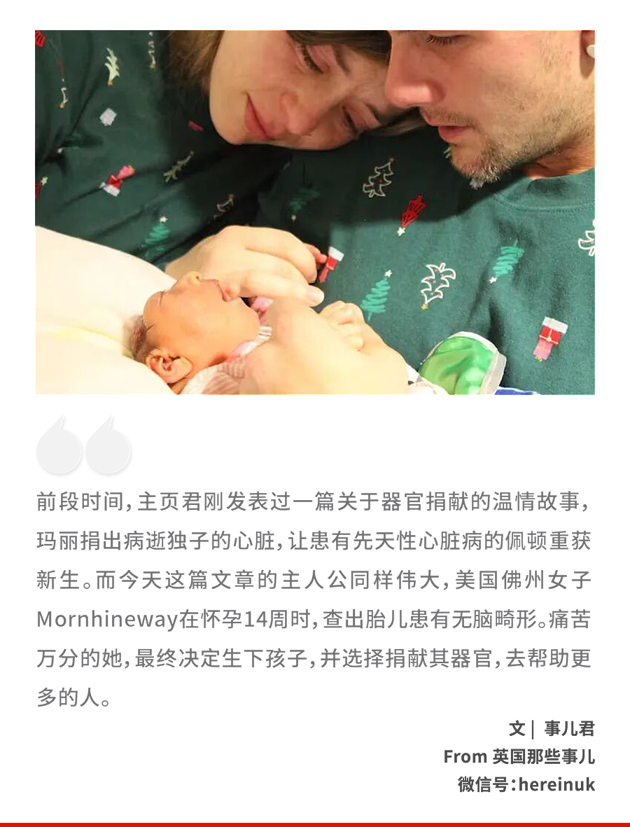 产检发现胎儿没大脑，出生即死亡！这对美国夫妻却非要生，理由很伟大.....（组图） - 1