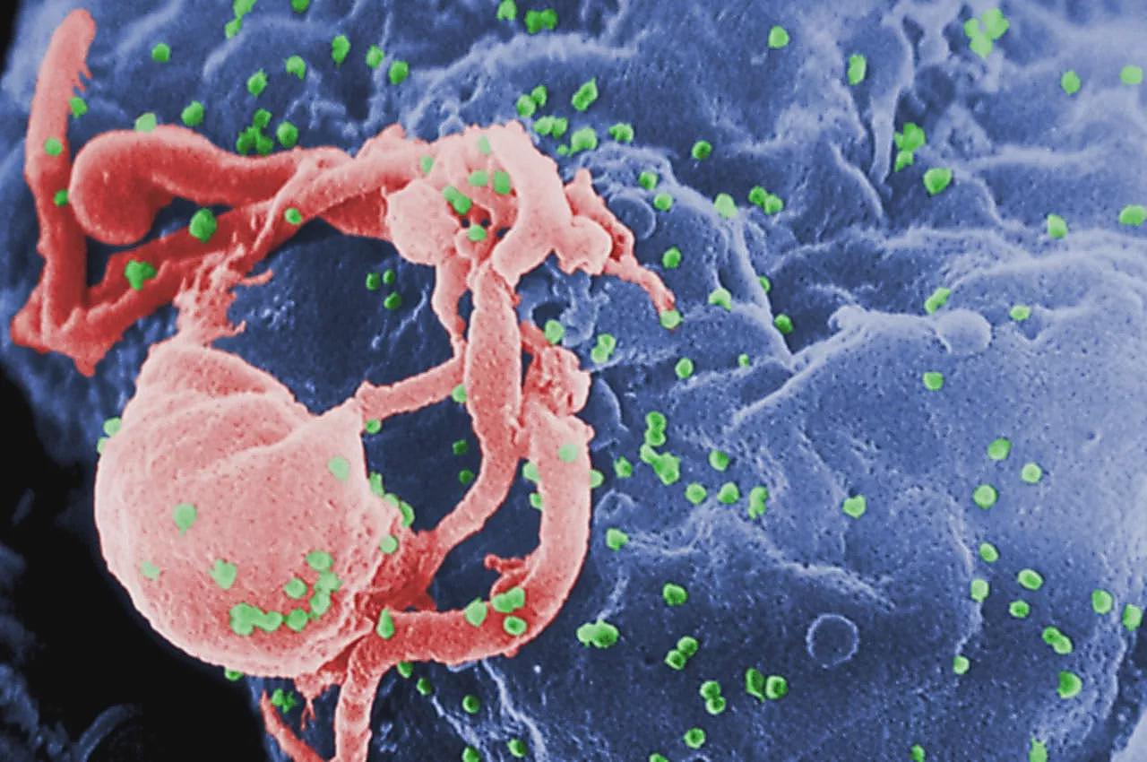 8旬翁与保母发生关系染HIV：老年爱滋患者持续上升（组图） - 3