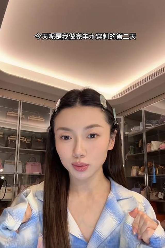 程晓玥公开做羊穿原因，NT增厚是重点，二胎还没生已经有三胎计划（组图） - 1