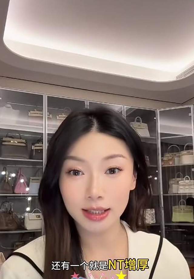 程晓玥公开做羊穿原因，NT增厚是重点，二胎还没生已经有三胎计划（组图） - 4