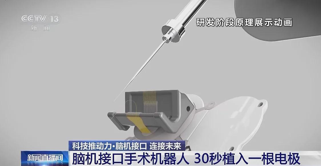 当脑机接口走入生活，会为我们带来哪些新可能？（组图） - 7