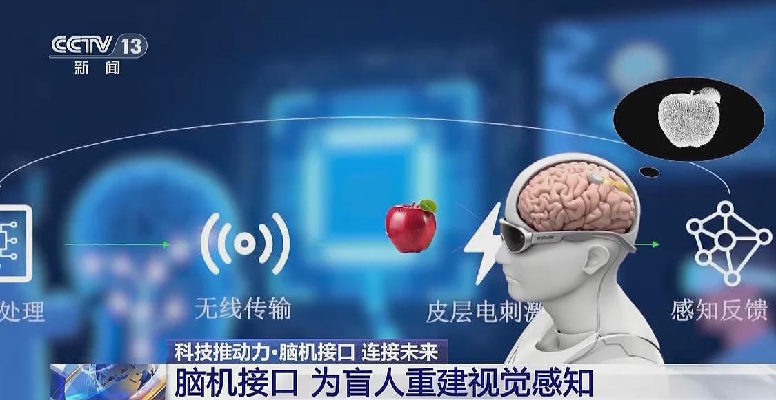 当脑机接口走入生活，会为我们带来哪些新可能？（组图） - 12