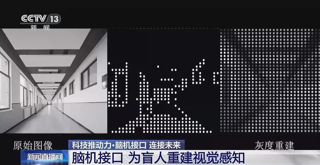 当脑机接口走入生活，会为我们带来哪些新可能？（组图） - 13