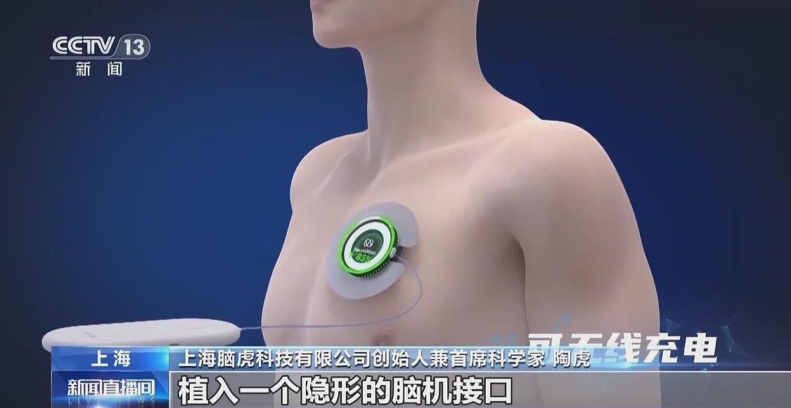 当脑机接口走入生活，会为我们带来哪些新可能？（组图） - 3