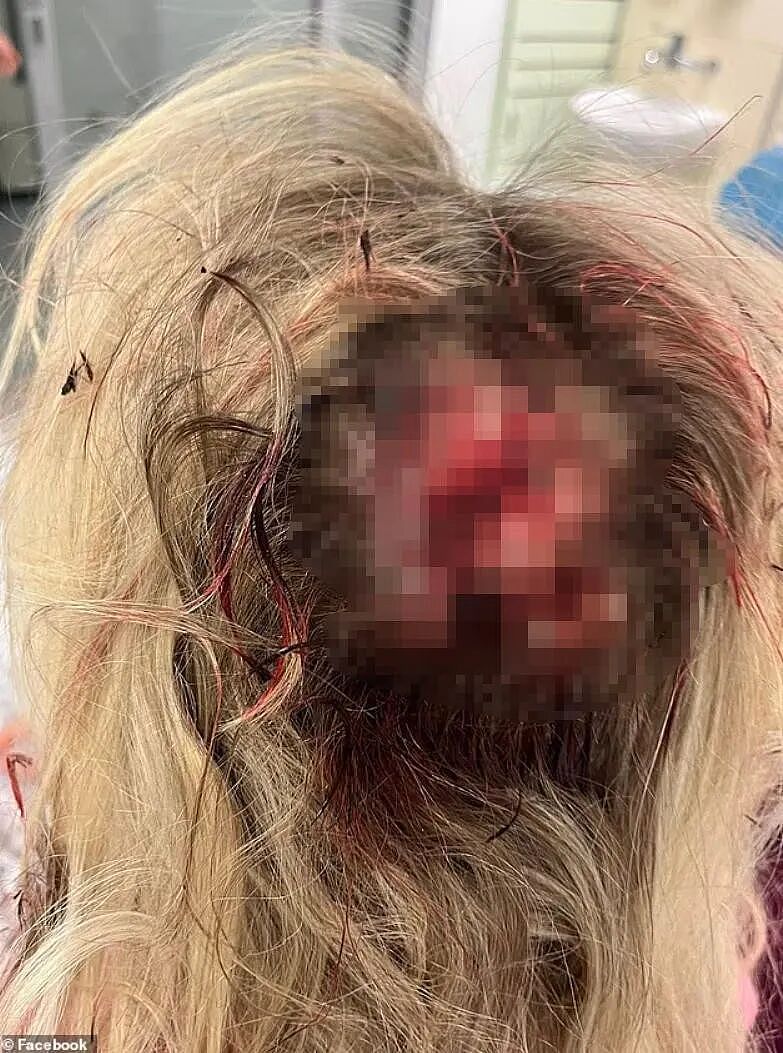英国也出医闹!男子预约被拒,用撬棍疯狂袭击6人?护士浑身是血逃出求救...(组图) - 2