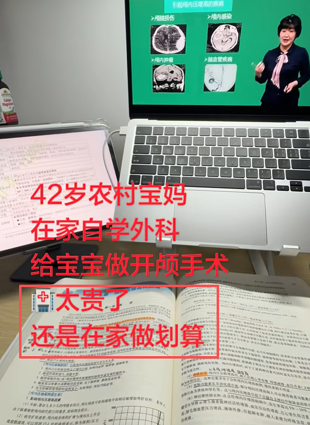宝妈自学开颅手术生三胎，还要自己接生第五胎，看完她操作步骤网友吓哭（组图） - 8