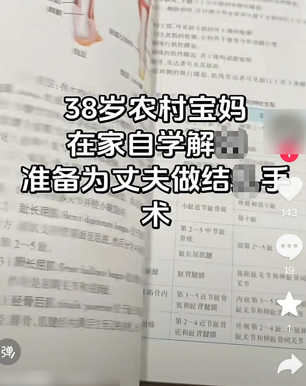 宝妈自学开颅手术生三胎，还要自己接生第五胎，看完她操作步骤网友吓哭（组图） - 3