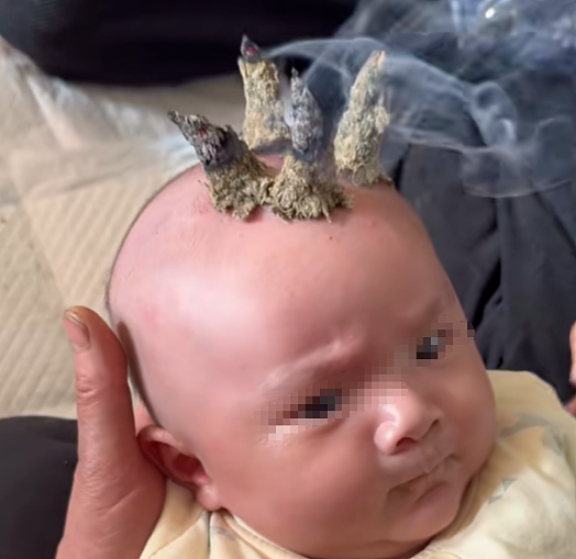 宝妈自学开颅手术生三胎，还要自己接生第五胎，看完她操作步骤网友吓哭（组图） - 13