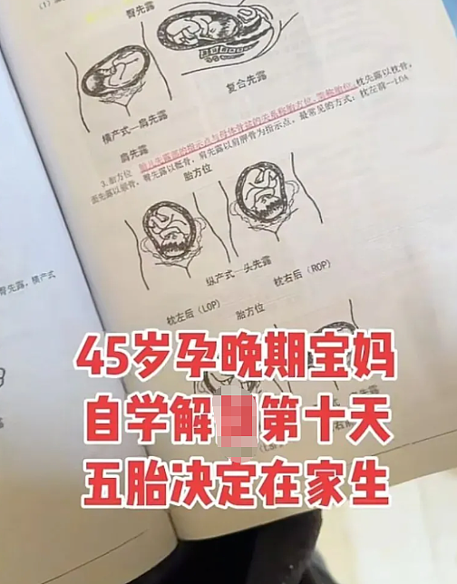宝妈自学开颅手术生三胎，还要自己接生第五胎，看完她操作步骤网友吓哭（组图） - 7