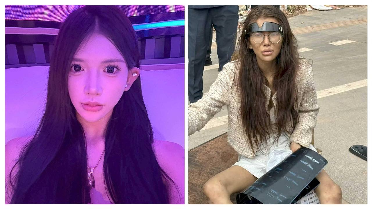 中国20岁女网红被男友骗至柬埔寨,如今双腿骨折流浪街头!中使馆回应(组图) - 1
