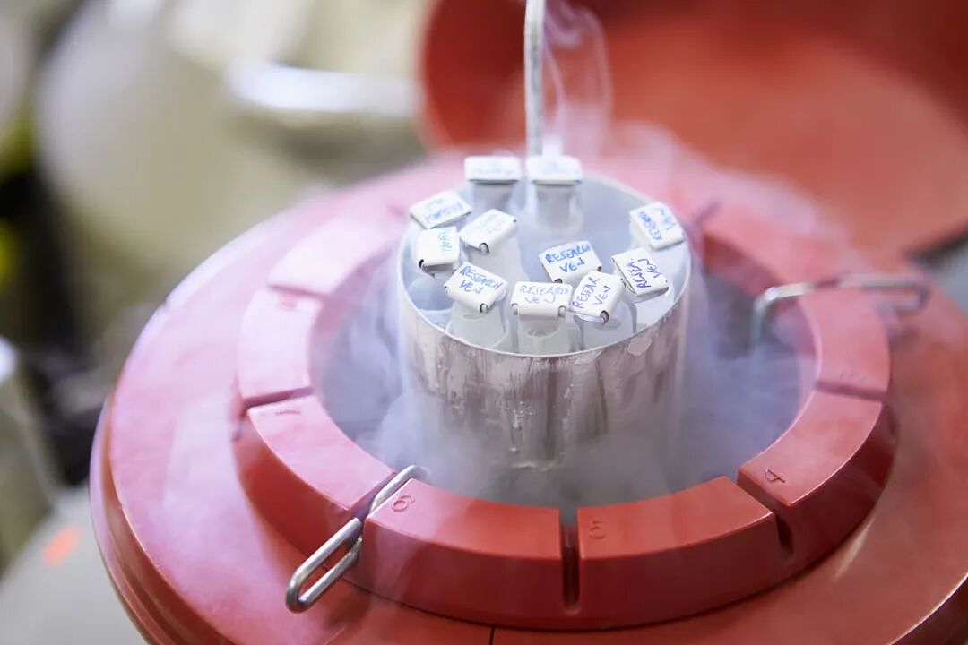 检查精子后，27岁健身教练崩溃！医生：这种“外强中干”已成普遍现象（组图） - 1