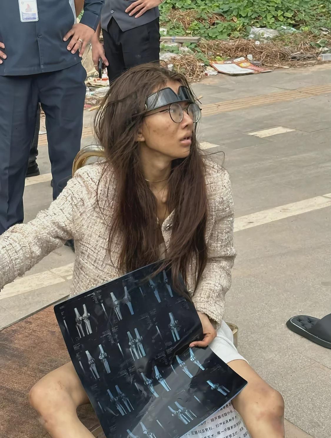 真的太惨！福建20岁女网红流落柬埔寨街头，膝盖疑似骨折！（组图） - 4