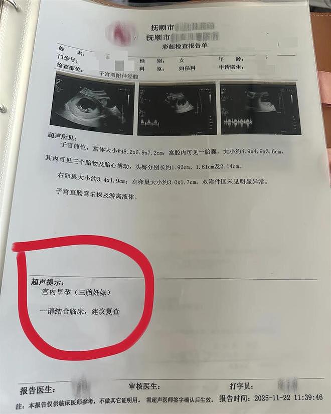 孕妇每次产检都发现多出一胎，医生：是罕见同卵四胞胎（组图） - 3