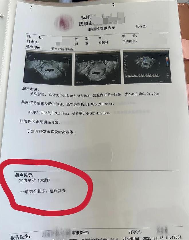 孕妇每次产检都发现多出一胎，医生：是罕见同卵四胞胎（组图） - 2