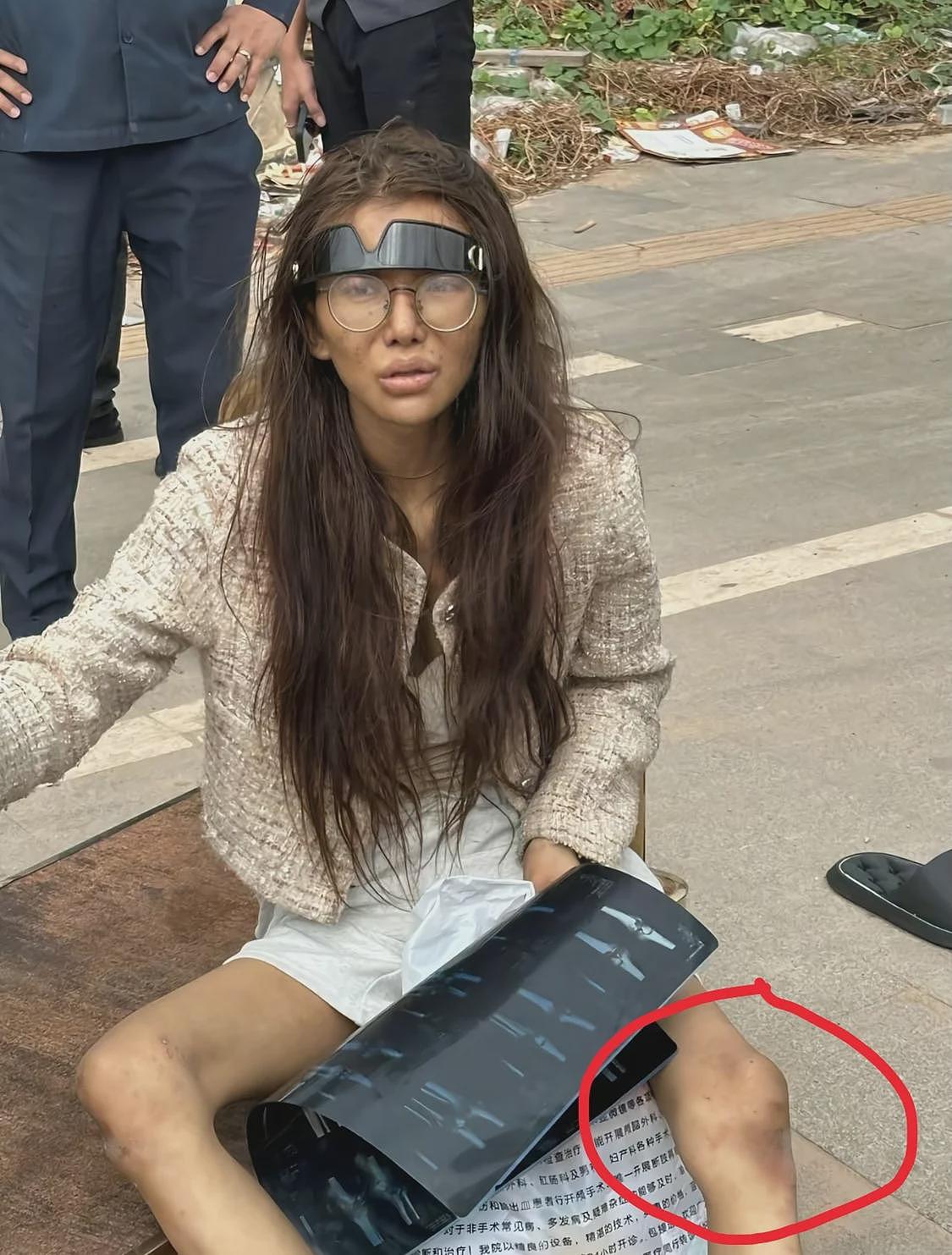 真的太惨！福建20岁女网红流落柬埔寨街头，膝盖疑似骨折！（组图） - 5