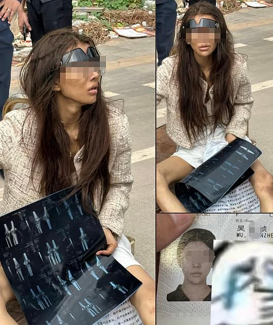 福建女网红在柬埔寨街头流浪?中使馆回应:在医院找到该女子,身体状况很差,自述受“高薪工作”诱惑来柬后流落街头(组图) - 2