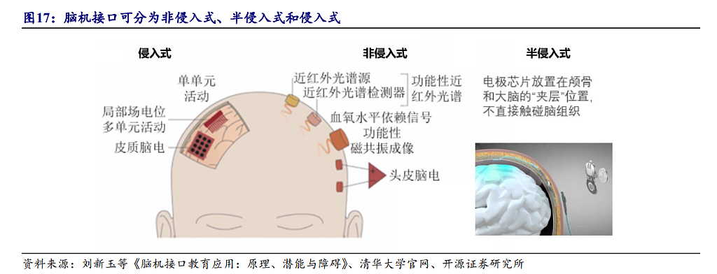 马斯克放出“量产时间表”，脑机接口集体涨停，商业化拐点来了？（组图） - 6