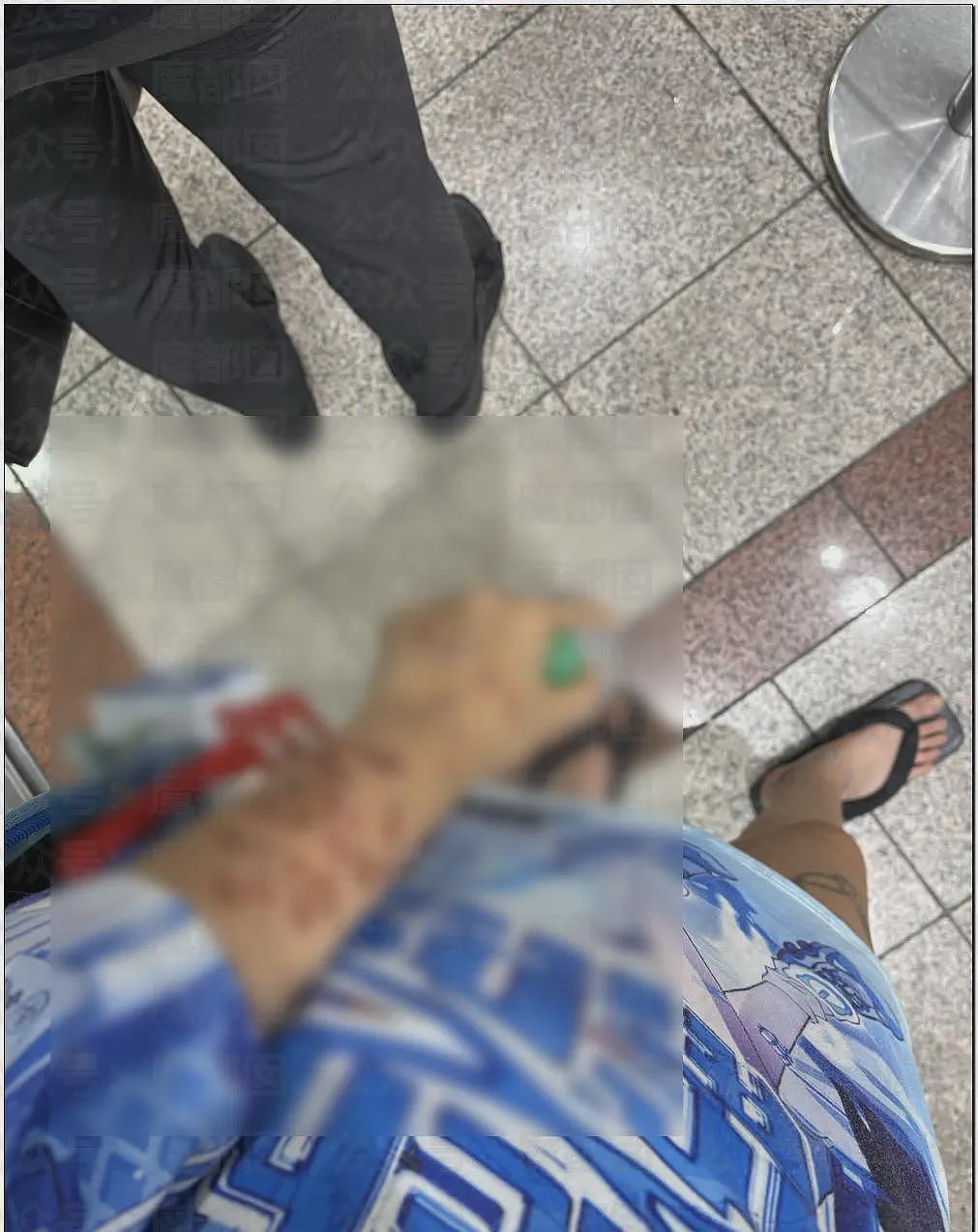 日本年轻人热衷梅毒文化震碎三观，还自残“模拟”病状（组图） - 11