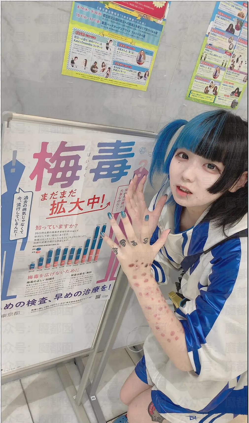 日本年轻人热衷梅毒文化震碎三观，还自残“模拟”病状（组图） - 6