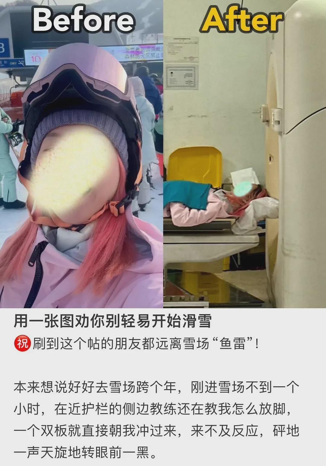 2026年第一批滑雪的中产，已骨折（组图） - 14