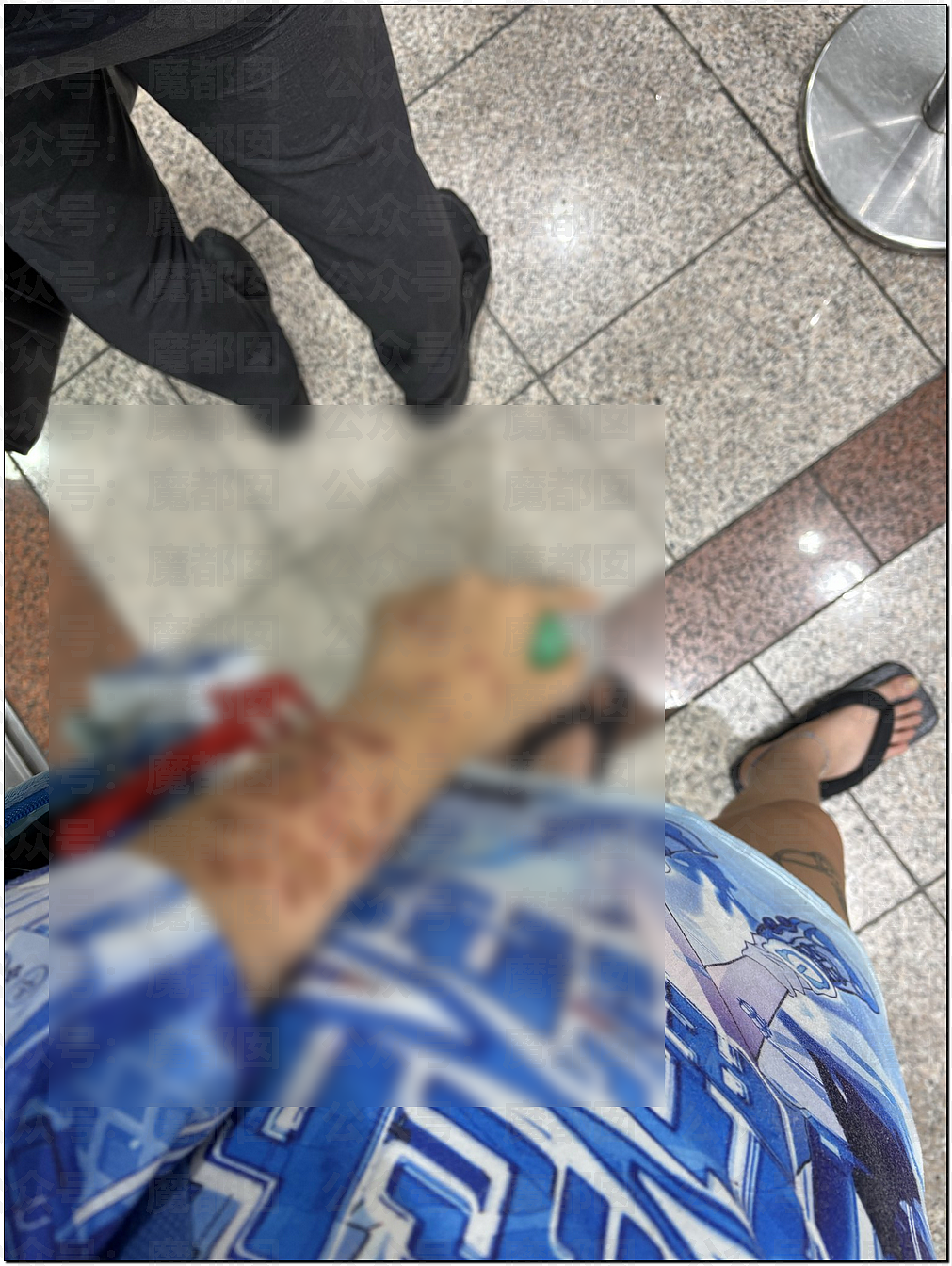 震碎三观!日本年轻人热衷梅毒文化,自残模仿聚众“亮伤”比烂(组图) - 11