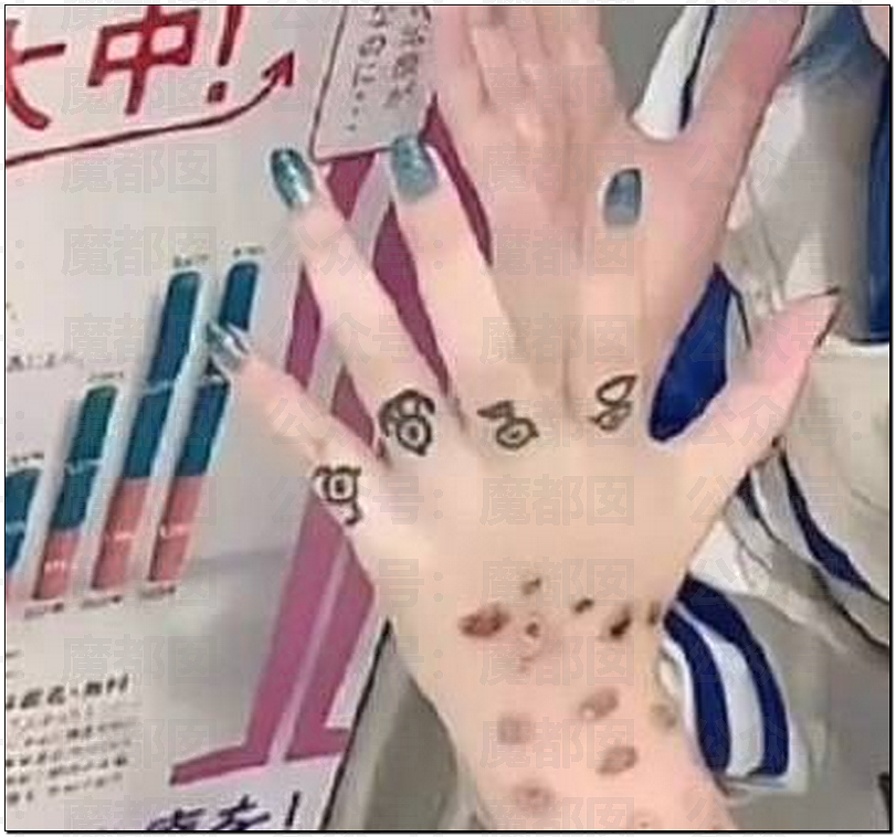 震碎三观!日本年轻人热衷梅毒文化,自残模仿聚众“亮伤”比烂(组图) - 1