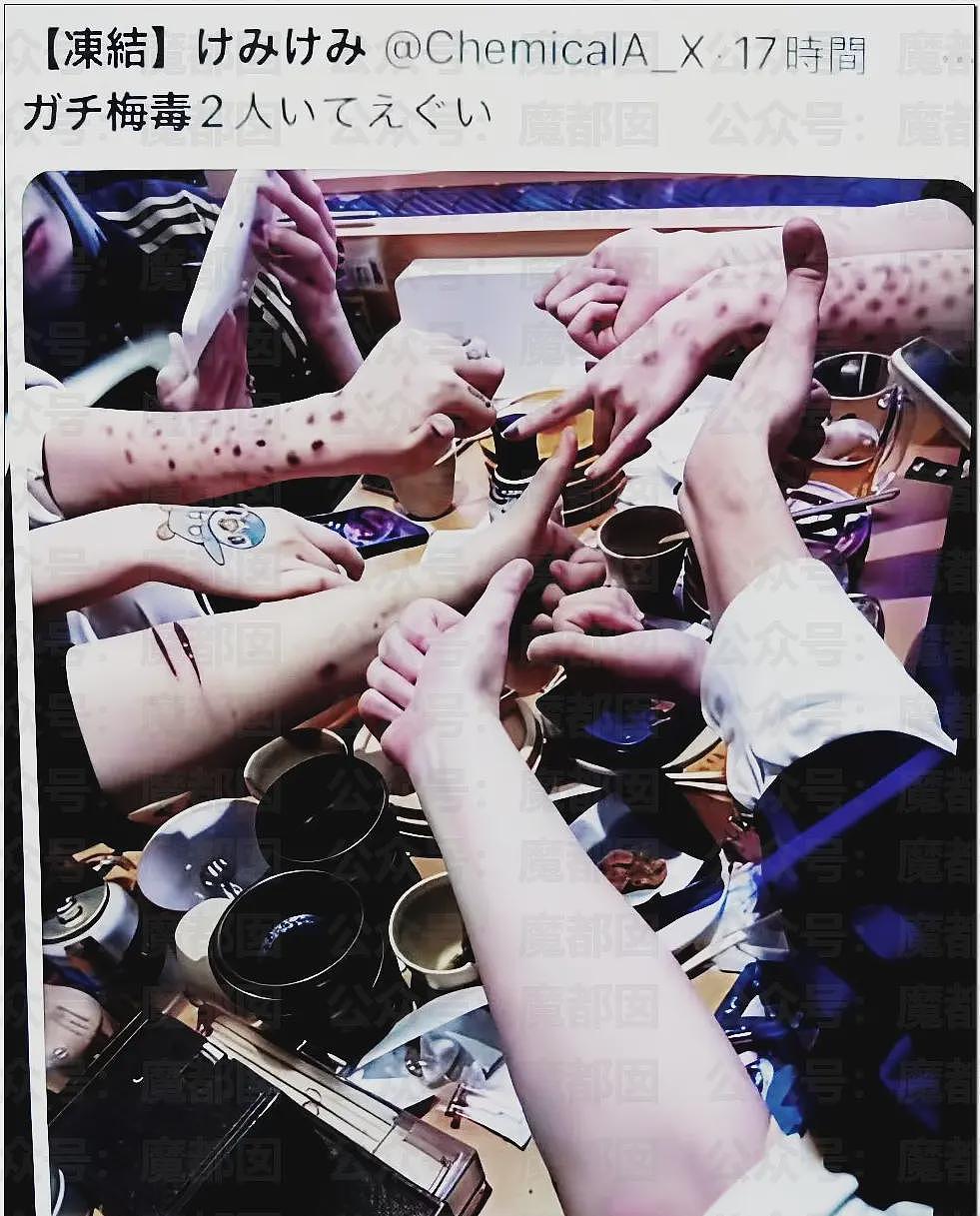 日本年轻人热衷梅毒文化震碎三观，还自残“模拟”病状（组图） - 2