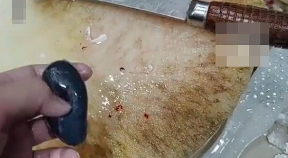 毒过砒霜！女子信偏方生吞鱼胆致急性肝衰竭，抢救5日执返条命（组图） - 3
