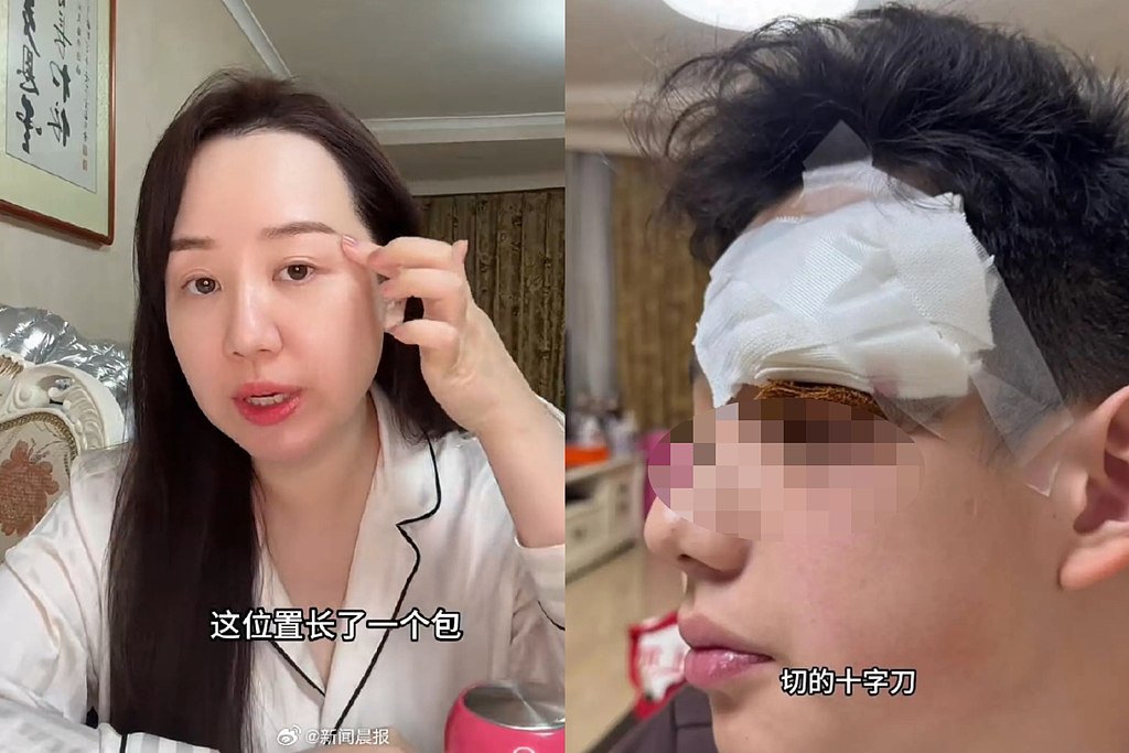 女星替13岁儿子挑痘酿祸,害缝4针!自责:心如刀割...(图) - 1