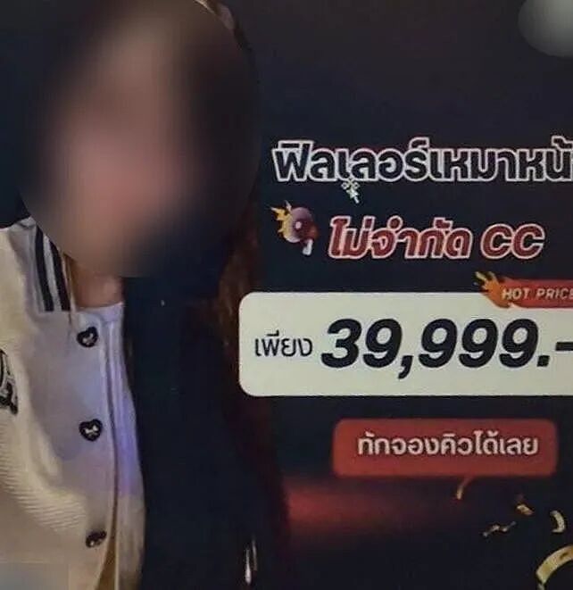 女子被忽悠打玻尿酸,结果嘴肿成香肠,脸肿成面包!两年过去还没恢复...(组图) - 1