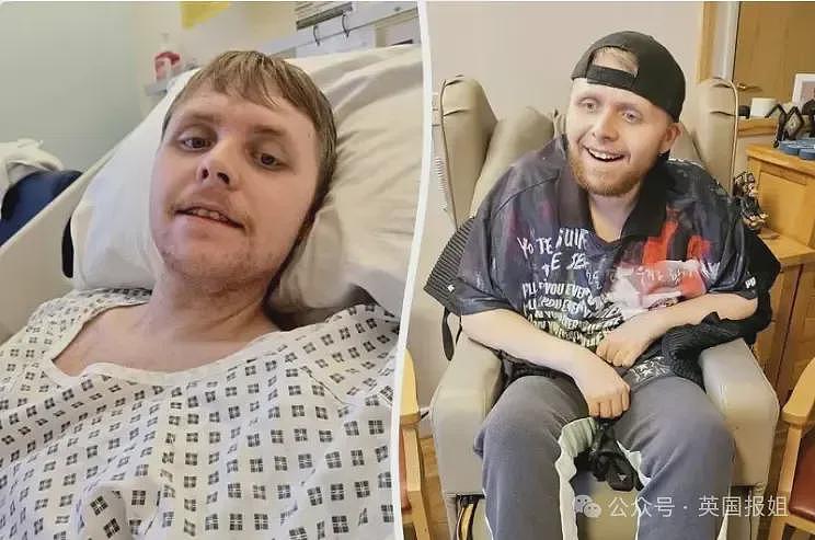 英24岁男子死于罕见痴呆症!大脑1年内衰老成70岁+(组图) - 1