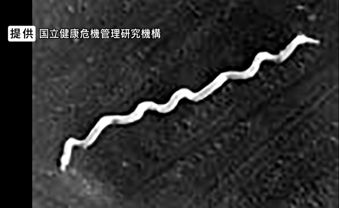 奇葩!日本年轻人热衷晒梅毒疤?感染人数连年暴增引担忧(组图) - 5