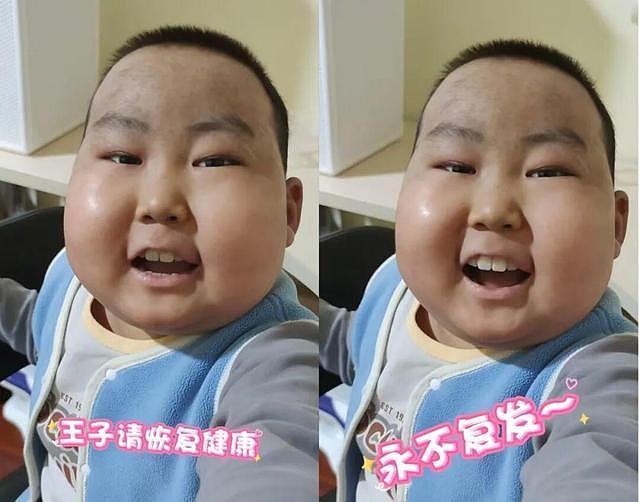 10岁抗癌“小王子”豪豪病情恶化，爸爸婉拒捐款，称不想再消耗爱心（组图） - 4