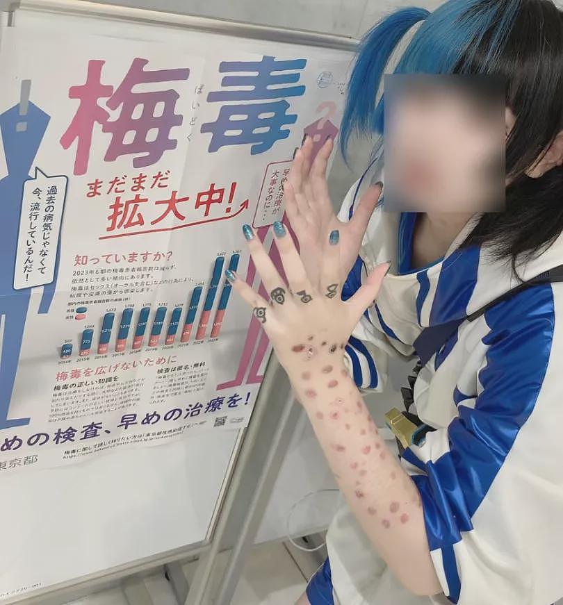 毁三观！日本青少年热衷炫耀“梅毒妆“，背后是日本梅毒感染率的逐年飙升...（组图） - 1