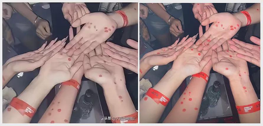 毁三观！日本青少年热衷炫耀“梅毒妆“，背后是日本梅毒感染率的逐年飙升...（组图） - 2
