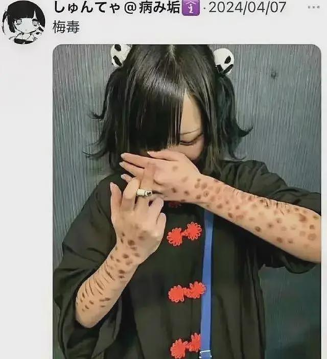 毁三观！日本青少年热衷炫耀“梅毒妆“，背后是日本梅毒感染率的逐年飙升...（组图） - 4