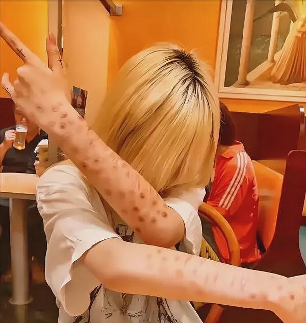 毁三观！日本青少年热衷炫耀“梅毒妆“，背后是日本梅毒感染率的逐年飙升...（组图） - 3