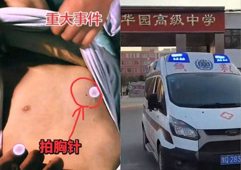 中国13岁学生猝死，左胸惊见钉子洞，网民震怒（图） - 1